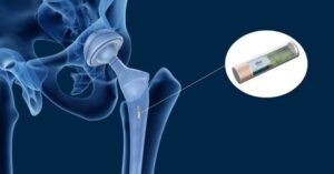 2 Stereax Solid State Batteries Enable Disruptive Product Design